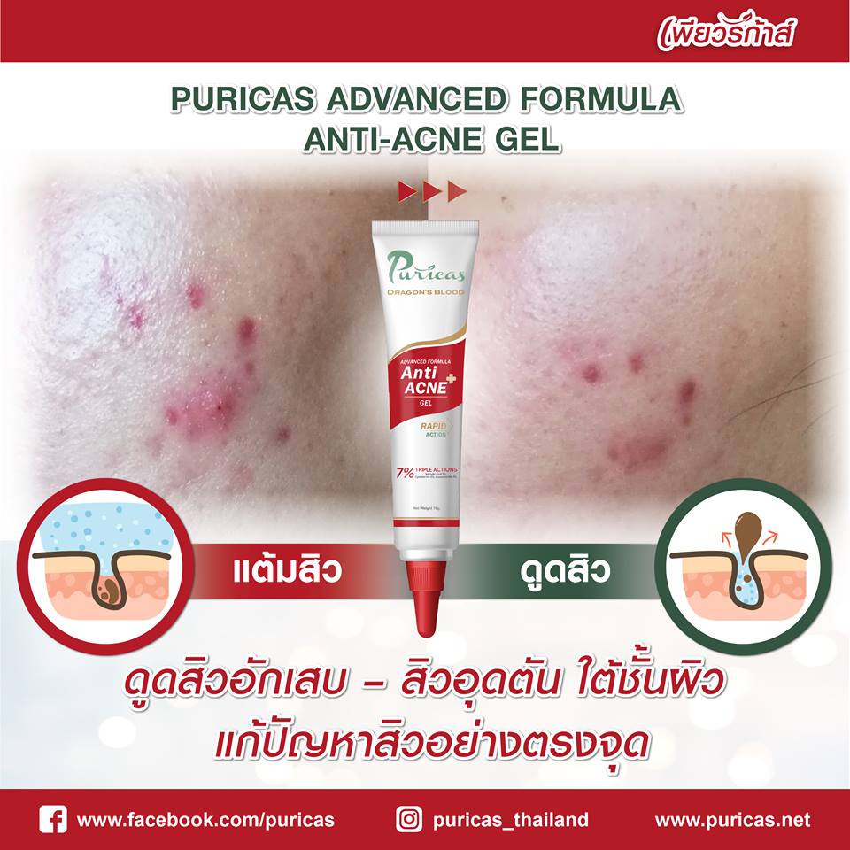 Puricas,เจลเเต้มสิว,เจลเเต้มสิวเพียวริก้า,Puricas Anti-Acne Gel,เพียวริก้า,เพียวริก้าราคา ,เพียวริก้ารีวิว ,เพียวริก้าเจล ราคา ,เพียวริก้า ซื้อที่ไหน